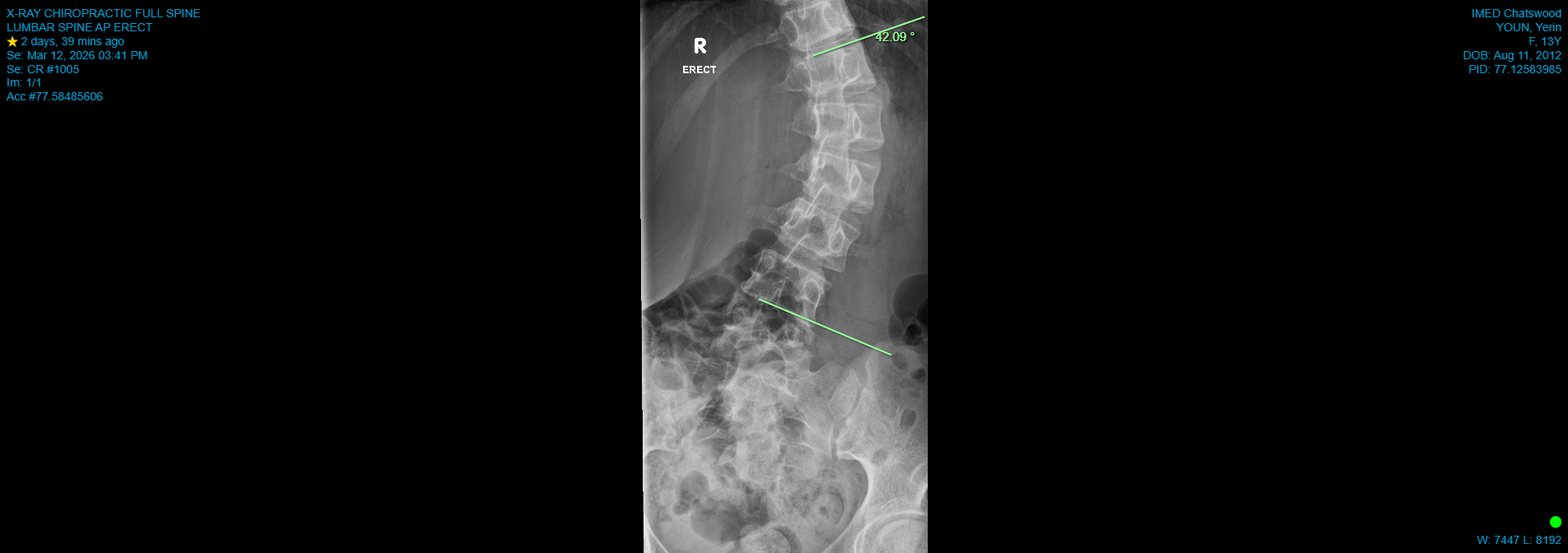 CR_X-RAY CHIROPRACTIC FULL SPINE_LUMBAR SPINE AP ERECT_2026-03-12.png