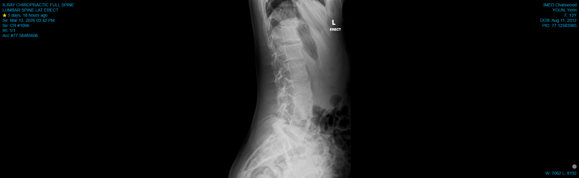 CR_X-RAY CHIROPRACTIC FULL SPINE_LUMBAR SPINE LAT ERECT_2026-03-12.png