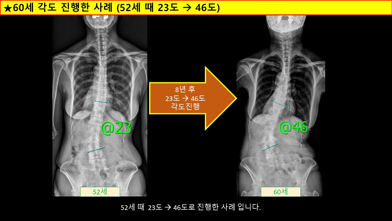60세.jpg