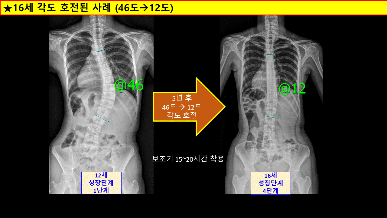 16세정상.gif