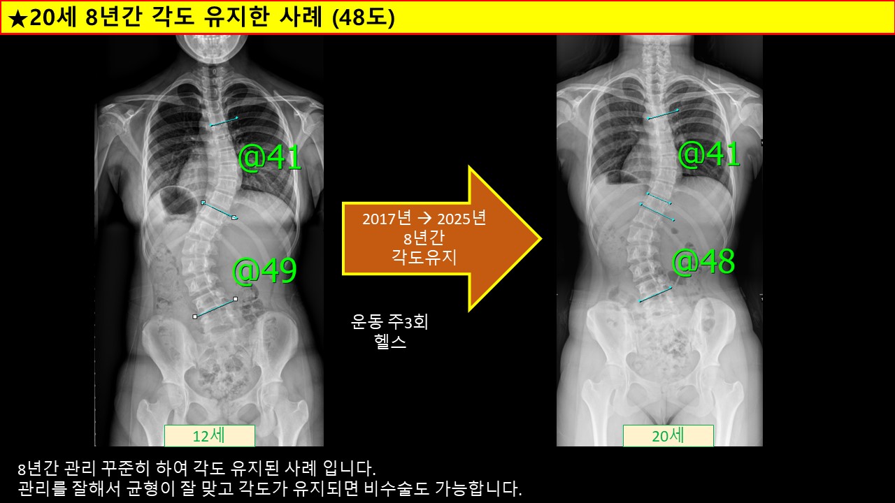 12 20 각도유지 비수술.jpg