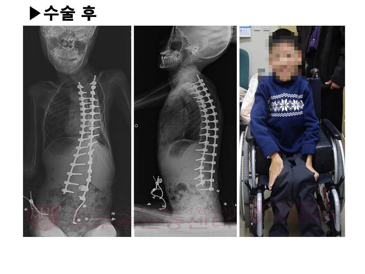 꾸미기_ead57adf8bfcfd67082479b6c37cb2bf_1.jpg