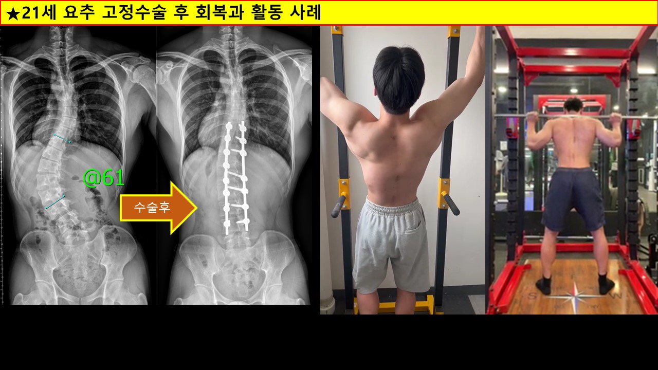 21세회복운동사례.jpg