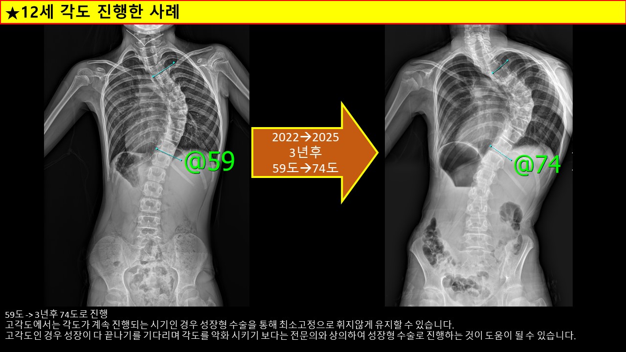 마젝.jpg